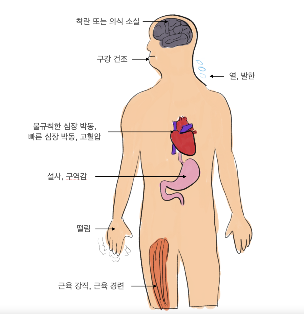 세로토닌 증후군 증상